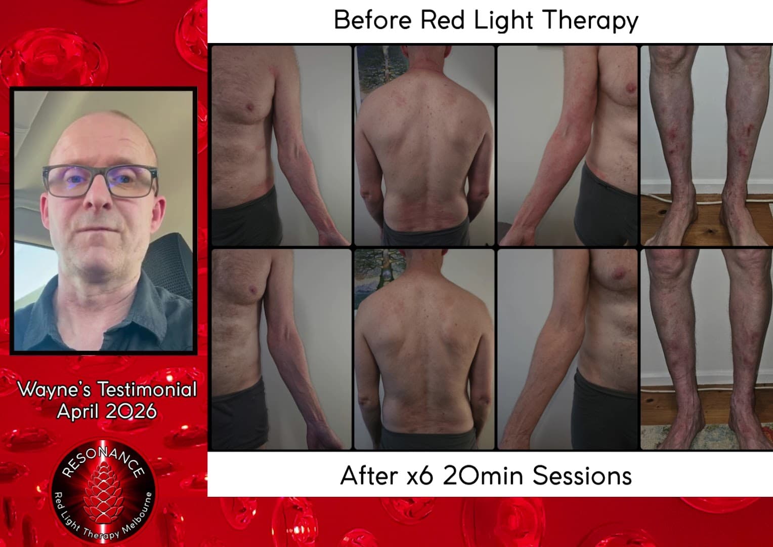 Resonance Red Light Therapy Melbourne photo 2